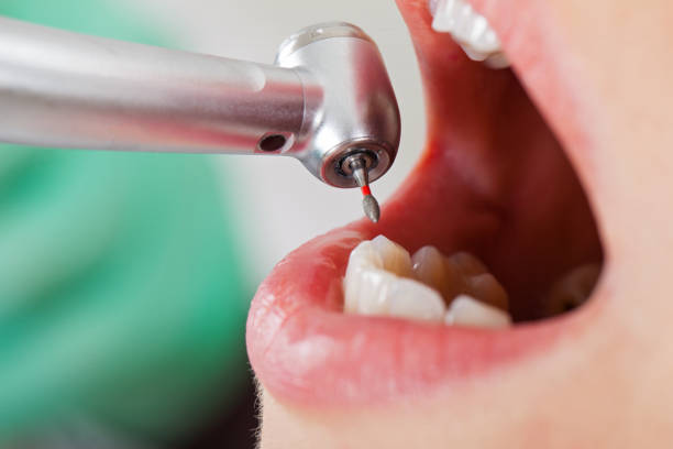 Best Walk-In Emergency Dental Services in Bellville, TX